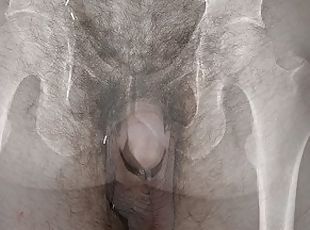 More than skin deep - an x-ray view of my dick!!